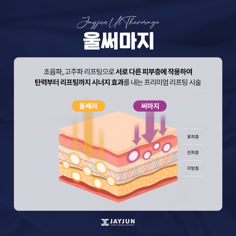 레이저 리프팅계 양대 산맥, 울쎄라+써마지 = 울써마지 관련 이미지 6
