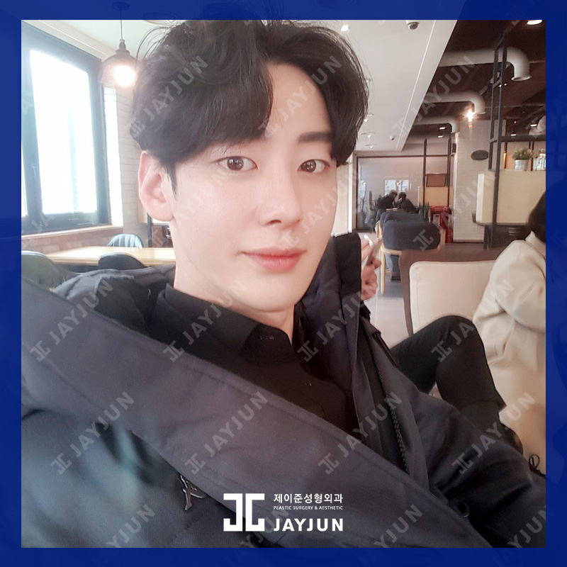 강남 남자코성형, 제이준성형외과의 접근방식은 달라! 관련 이미지 4