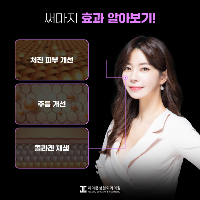 써마지리프팅 핵심은 바로 이것 관련 이미지 3