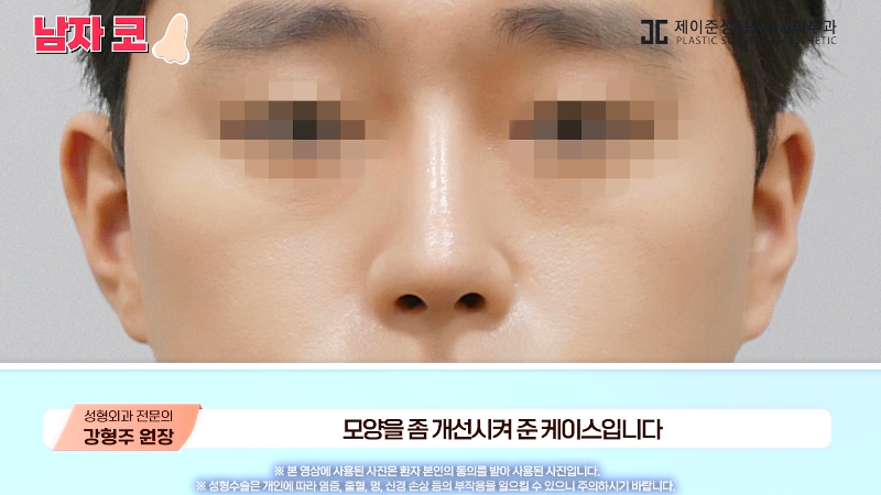 [제이준성형외과&middot;피부과] 남자 인상의 결정적인 부위 관련 이미지 20