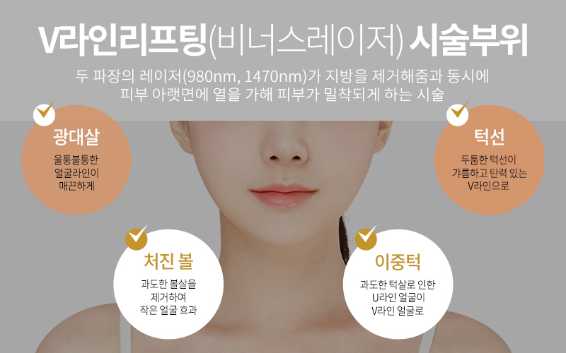 강남역성형외과 비너스레이저, 이중턱제거하고 동안얼굴 만드는 방법 관련 이미지 5