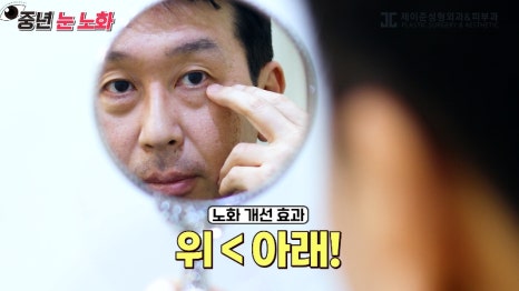 [제이준성형외과&middot;피부과] 🚨성형외과 전문의가 알려주는 눈 노화 신호🚨 관련 이미지 22
