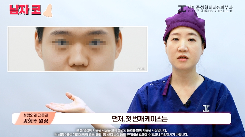 [제이준성형외과&middot;피부과] 남자 인상의 결정적인 부위 관련 이미지 9