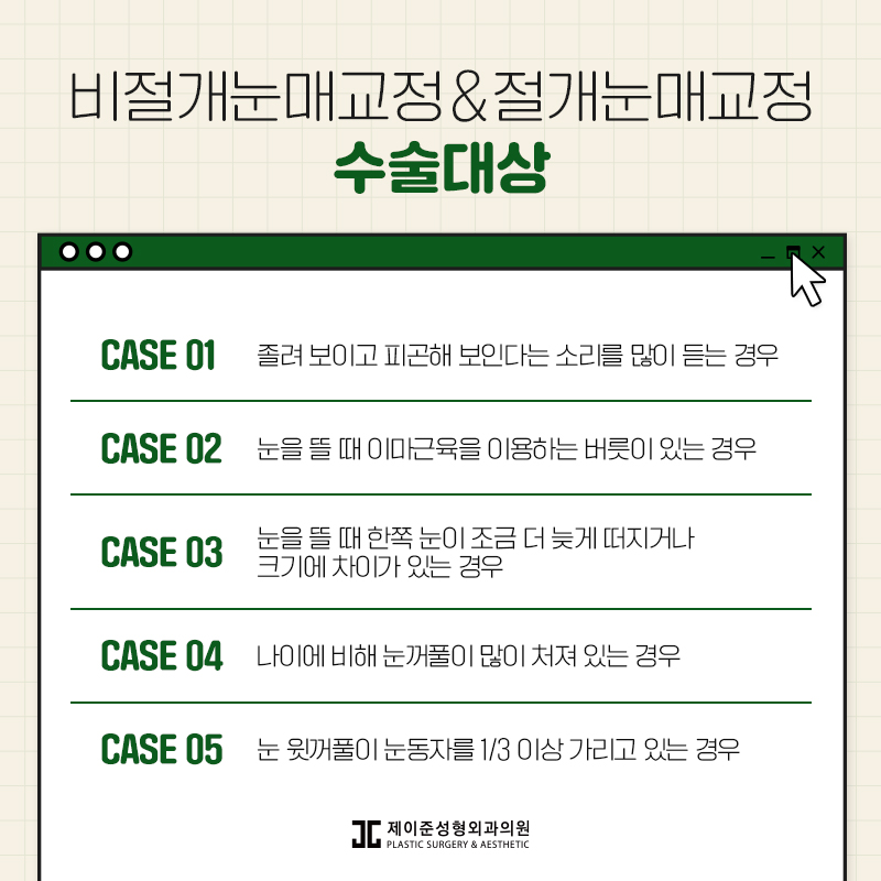 눈매교정 , 절개 / 비절개 차이점은? 관련 이미지 4