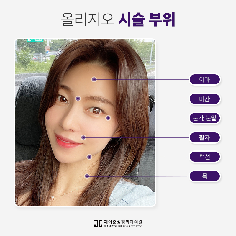 탄력잃고 처진 얼굴에는 올리지오리프팅 관련 이미지 5