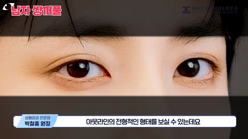 [Jeijun Plastic Surgery & Dermatology] Types and Features of Men’s Double Eyelid Lines Seen Through Celebrities! image 26