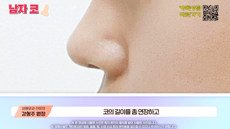 [제이준성형외과&middot;피부과] 남자 인상의 결정적인 부위 관련 이미지 14