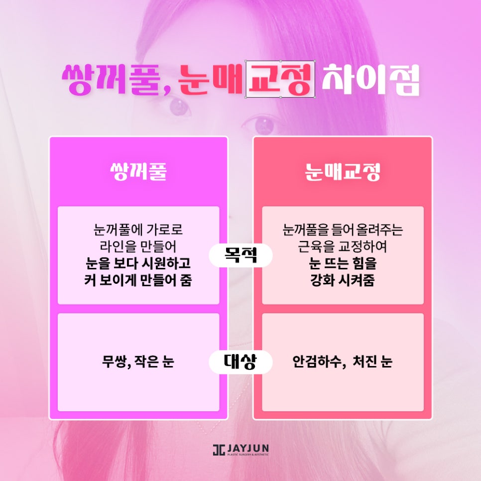 생기있고! 또렷하게! 제이준 눈매교정 관련 이미지 4