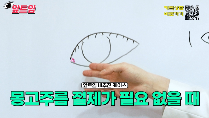 [Jaejune Plastic Surgery & Dermatology] Why is epicanthoplasty necessary? Everything about epicanthoplasty!! image 23