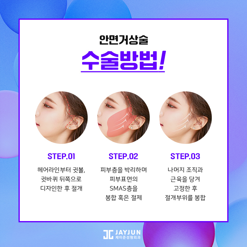 제이준성형외과 안면거상술 , SMAS층까지 당겨야 효과 좋아 관련 이미지 5