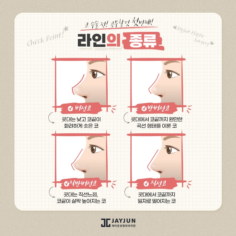 코성형, 꼭 알아야할 정보 모음 관련 이미지 3