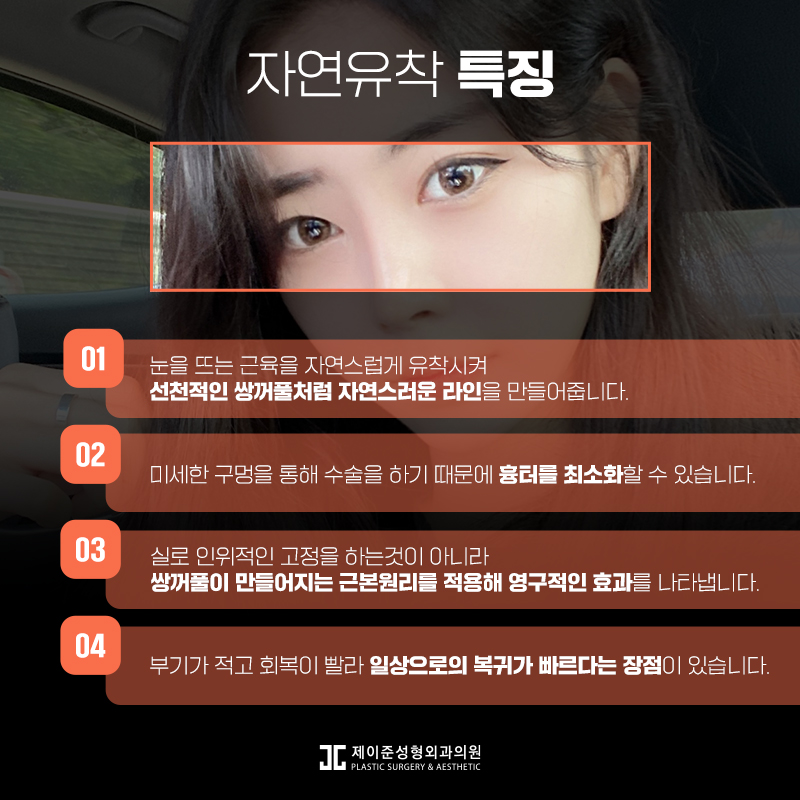 자연스러운 라인을 위한 자연유착 관련 이미지 5