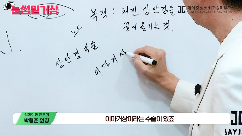 [제이준성형외과&middot;피부과] 쌍꺼풀 라인 변화 없이 눈매 개선은 확실하게! #눈썹밑거상 관련 이미지 4