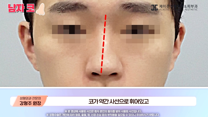 [제이준성형외과&middot;피부과] 남자 인상의 결정적인 부위 관련 이미지 17