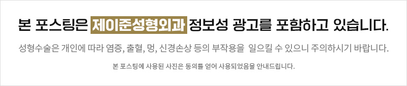 레이저 리프팅계 양대 산맥, 울쎄라+써마지 = 울써마지 관련 이미지 12