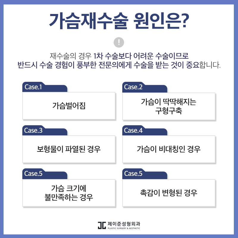 가슴재수술 , 실패 원인에 따른 수술 계획이 중요 관련 이미지 2