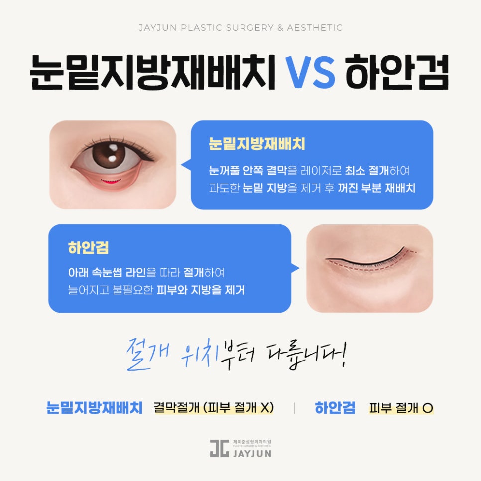 [Jaejun Plastic Surgery & Dermatology] Under-eye fat: Under-eye fat repositioning vs. lower blepharoplasty — which procedure is right for me? image 6