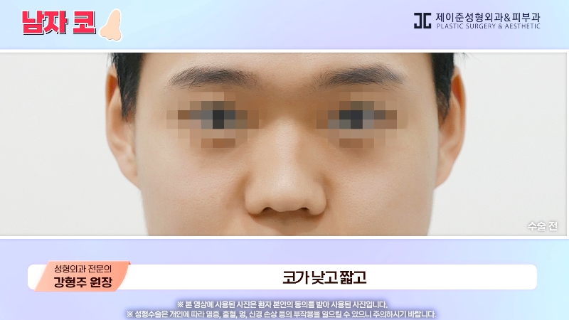 [제이준성형외과&middot;피부과] 남자 인상의 결정적인 부위 관련 이미지 10
