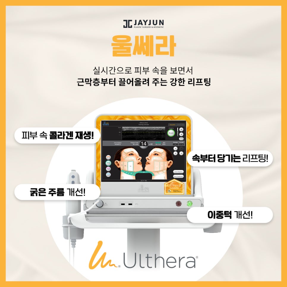 레이저 리프팅계 양대 산맥, 울쎄라+써마지 = 울써마지 관련 이미지 4