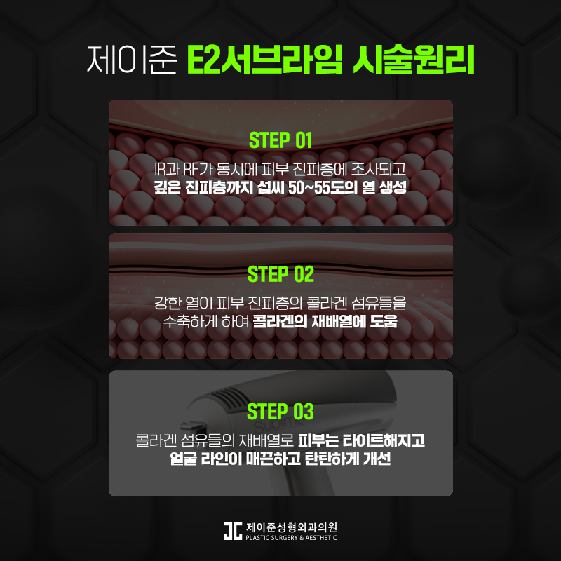 e2서브라임 리프팅이란? 관련 이미지 4