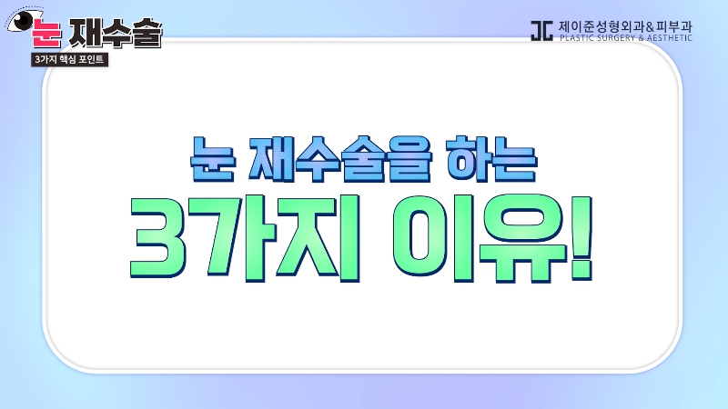 [제이준 유튜브] 눈 재수술을 막기위한 3가지 포인트! 관련 이미지 1