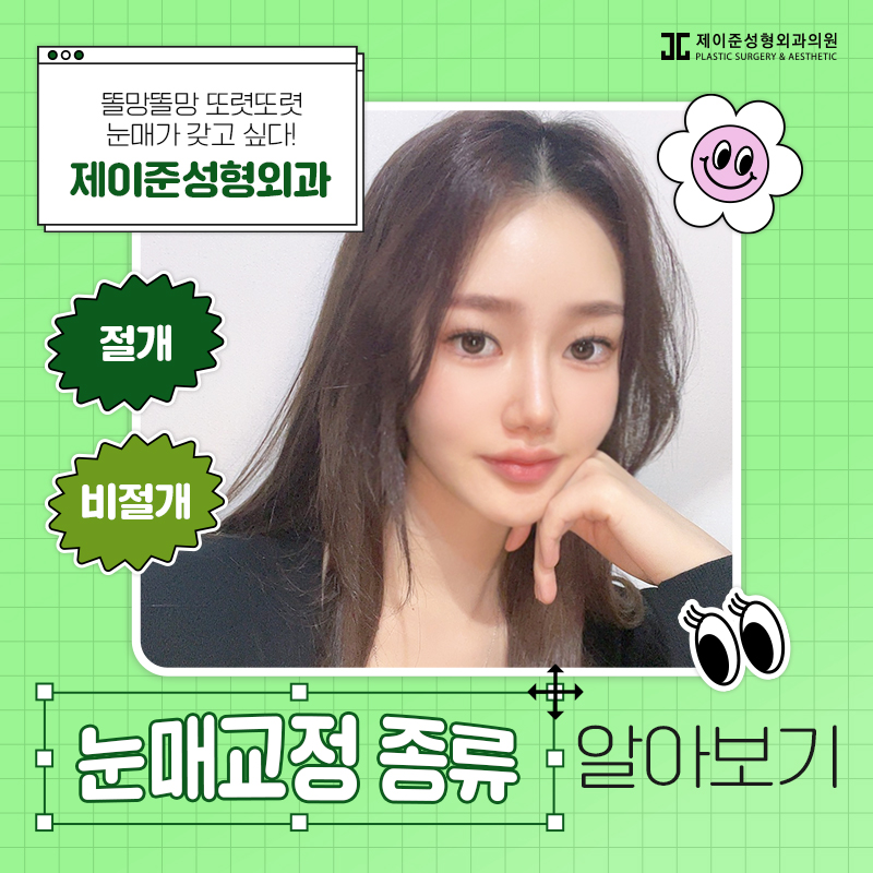 눈매교정 , 절개 / 비절개 차이점은? 관련 이미지 1