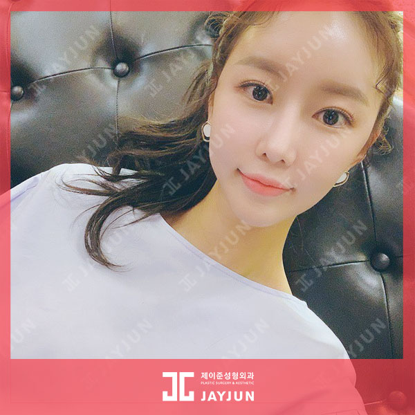 강남역피부과 입꼬리보톡스 + 용량무제한 입술필러 이벤트 한대요!? 관련 이미지 6