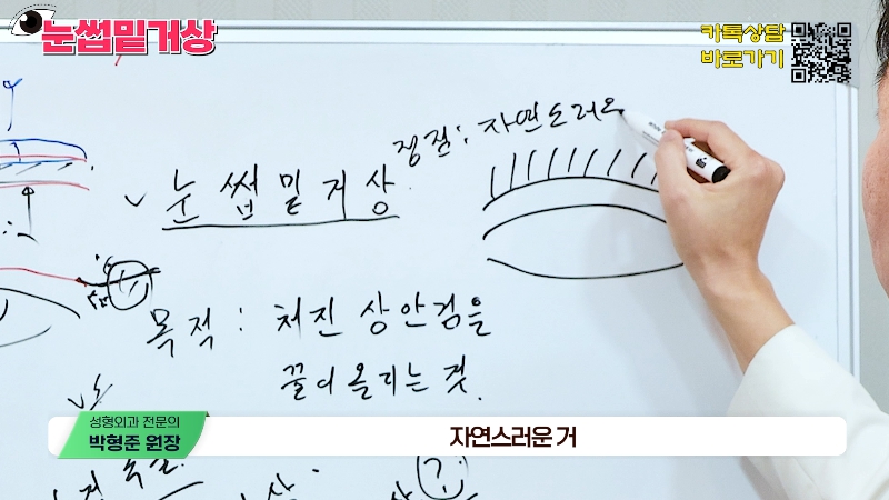 [제이준성형외과&middot;피부과] 쌍꺼풀 라인 변화 없이 눈매 개선은 확실하게! #눈썹밑거상 관련 이미지 12