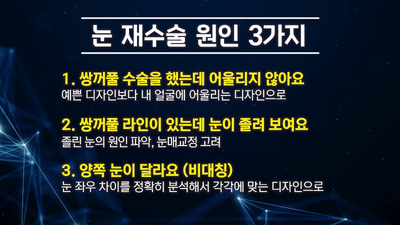 [제이준 유튜브] 눈 재수술을 막기위한 3가지 포인트! 관련 이미지 11