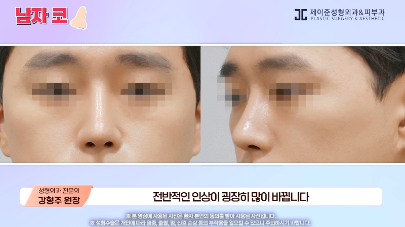 [제이준성형외과&middot;피부과] 남자 인상의 결정적인 부위 관련 이미지 29