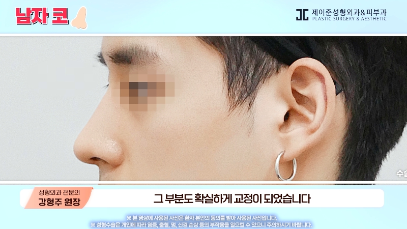 [제이준성형외과&middot;피부과] 남자 인상의 결정적인 부위 관련 이미지 27