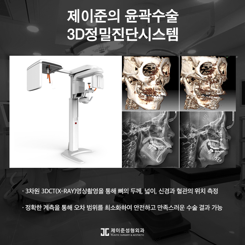 남자안면윤곽술, 부드럽고 샤프한 인상으로! 관련 이미지 8