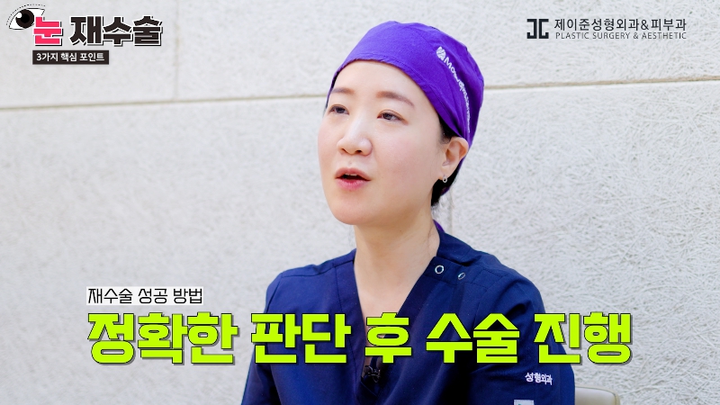 [제이준 유튜브] 눈 재수술을 막기위한 3가지 포인트! 관련 이미지 16