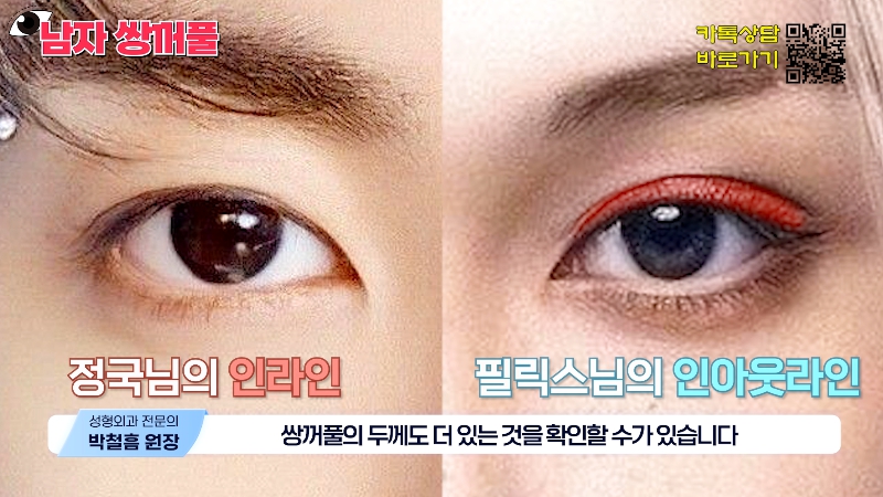 [Jeijun Plastic Surgery & Dermatology] Types and Features of Men’s Double Eyelid Lines Seen Through Celebrities! image 17