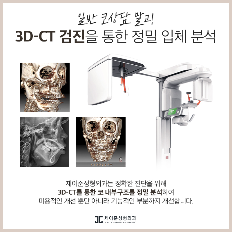 매부리코 교정 , 유형과 상태에 따라 진행돼야 관련 이미지 7
