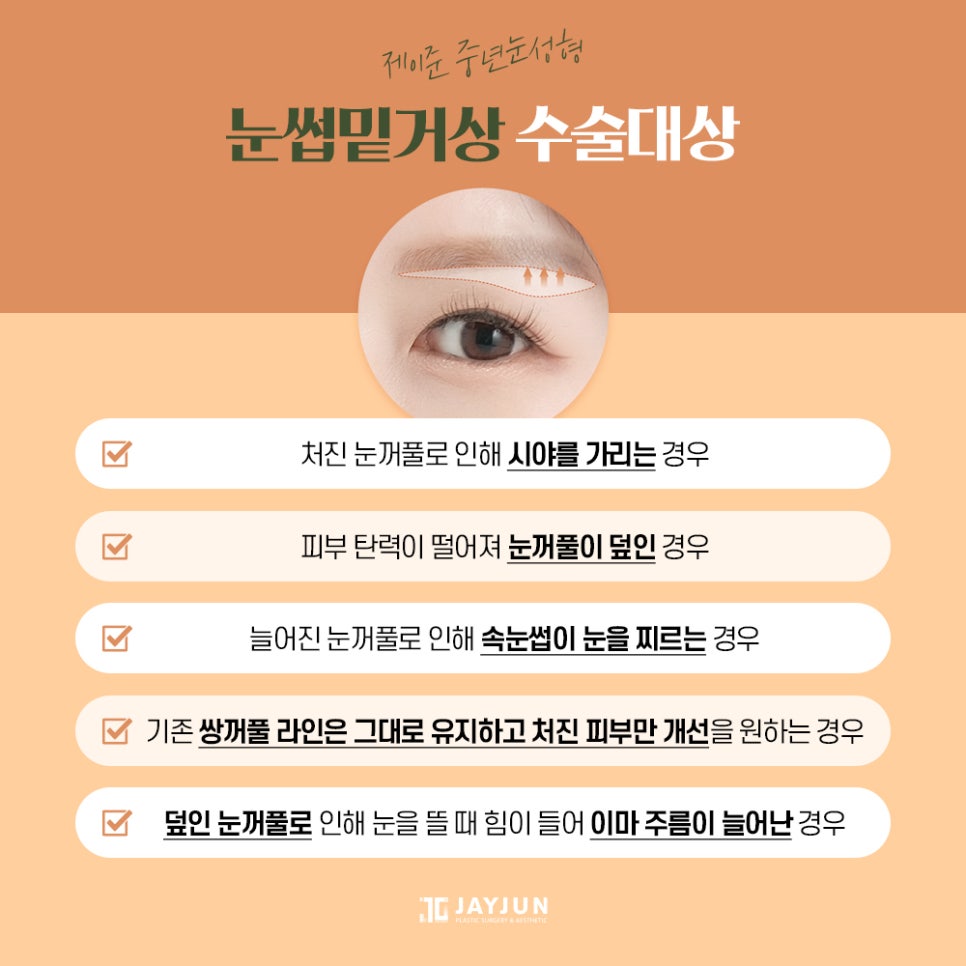 [제이준성형외과] 주름개선과 동안눈매를 한번에! 중년눈성형 눈썹밑거상 관련 이미지 4