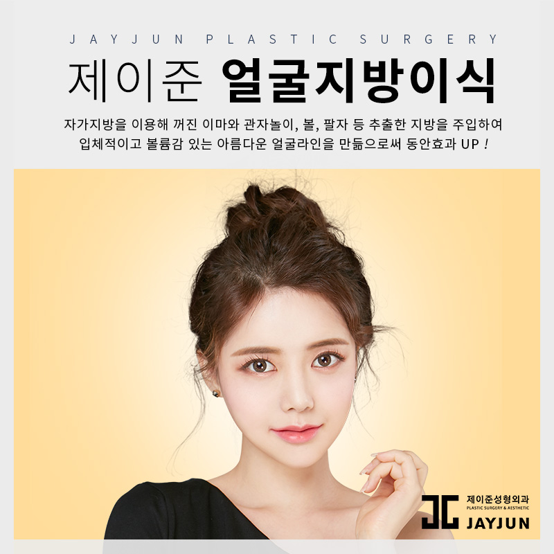 역삼역 제이준성형외과, 얼굴지방이식 비율까지 생각해! 관련 이미지 1