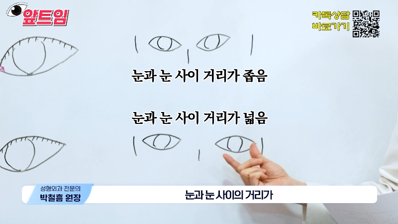 [Jaejune Plastic Surgery & Dermatology] Why is epicanthoplasty necessary? Everything about epicanthoplasty!! image 9