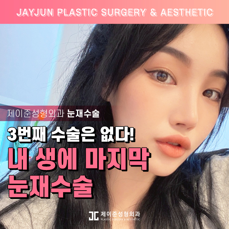 두번의 실패는 없을 제이준성형외과 눈재수술 관련 이미지 1