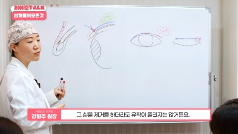 [제이준성형외과&middot;피부과] 비절개&middot;부분절개&middot;절개 쌍꺼풀의 원리와 차이점! 관련 이미지 33