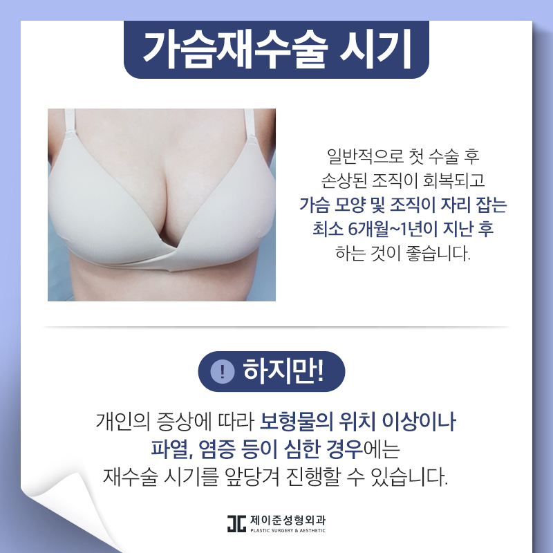 가슴재수술 , 실패 원인에 따른 수술 계획이 중요 관련 이미지 3