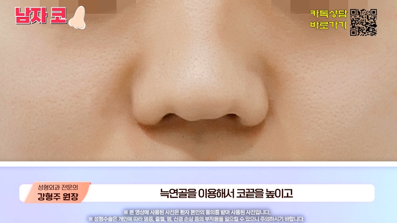 [제이준성형외과&middot;피부과] 남자 인상의 결정적인 부위 관련 이미지 13
