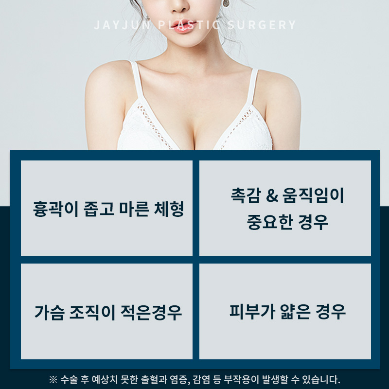 제이준성형외과│자연스러운 실루엣 - 벨라젤 가슴성형 ! 관련 이미지 4