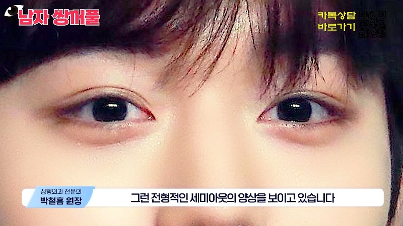 [Jeijun Plastic Surgery & Dermatology] Types and Features of Men’s Double Eyelid Lines Seen Through Celebrities! image 22