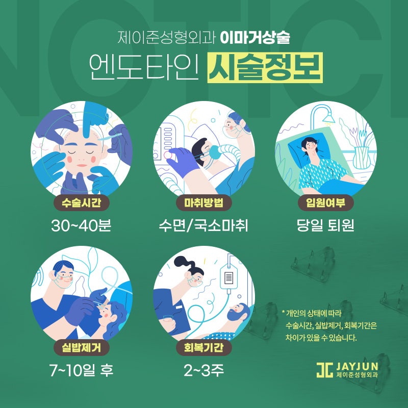 엔도타인 이마거상술 추천드리는 곳 관련 이미지 3