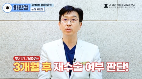 [제이준 유튜브] 하안검 무엇이든 물어보세요! 관련 이미지 5