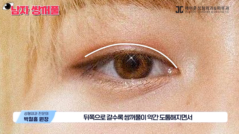 [Jeijun Plastic Surgery & Dermatology] Types and Features of Men’s Double Eyelid Lines Seen Through Celebrities! image 16