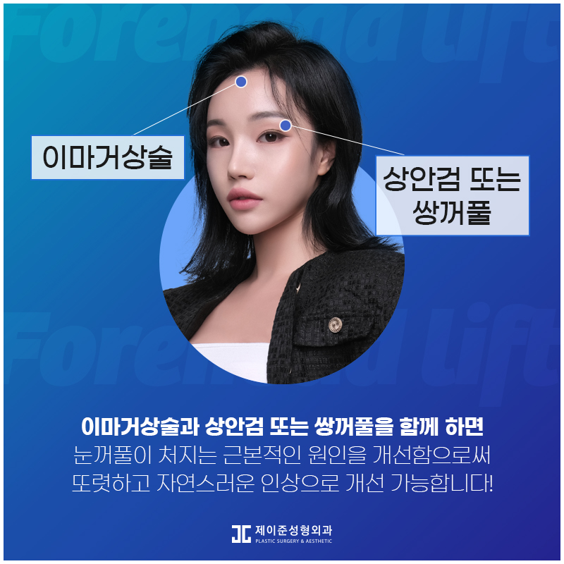 노화증상 개선하고 동안외모로! 엔도타인 이마거상술 관련 이미지 8