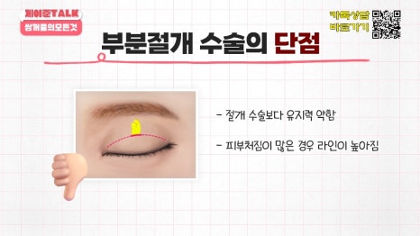 [제이준성형외과&middot;피부과] 비절개&middot;부분절개&middot;절개 쌍꺼풀의 원리와 차이점! 관련 이미지 16