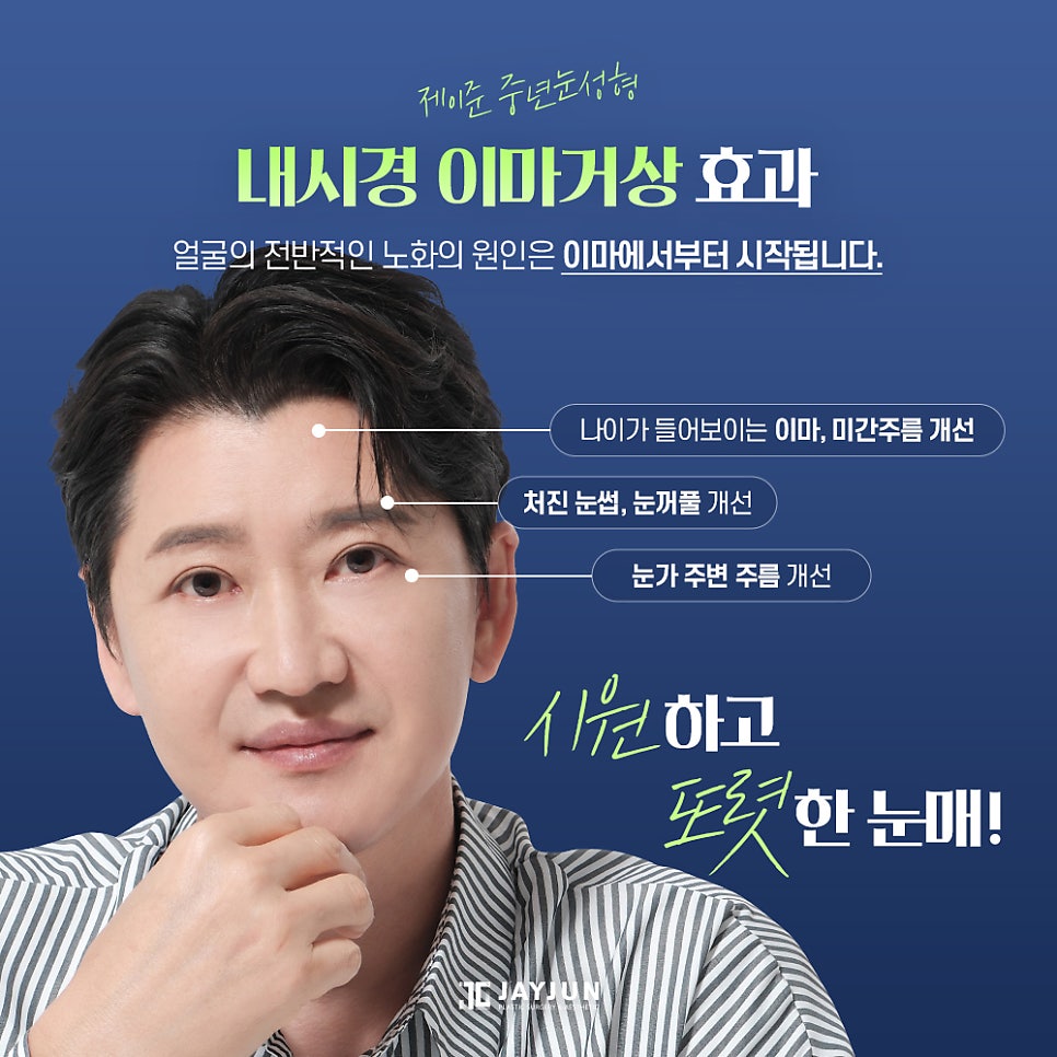 [제이준 성형외과] 이마 주름과 처진 눈매 개선에는! 제이준 중년눈성형 내시경 이마거상 관련 이미지 6